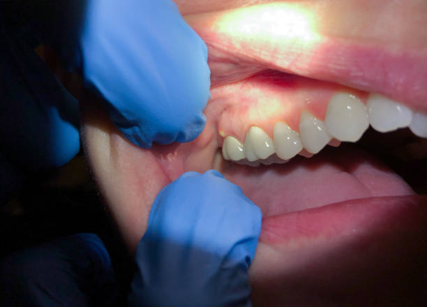 Best Tooth Pain Emergency Relief  in Rollingwood, TX
