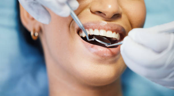 Best Urgent Tooth Repair  in Rollingwood, TX