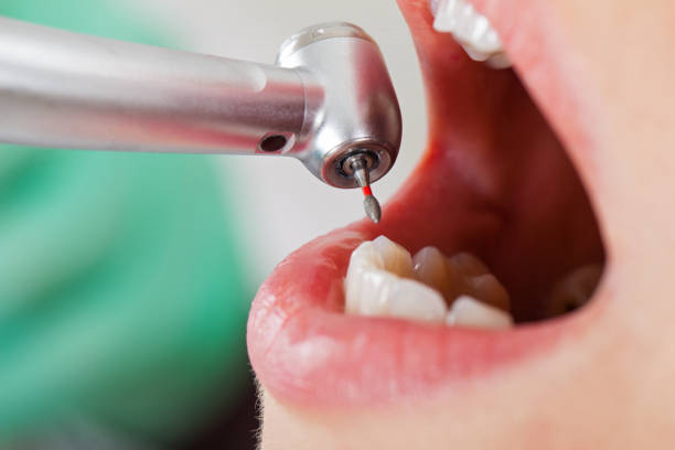 Best Broken Tooth Emergency  in Rollingwood, TX